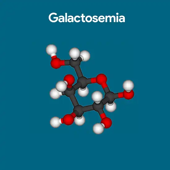 Galactosemia (Epimerase) Quantitative, Blood Test